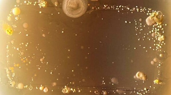 bacteria7_610x397-600x390