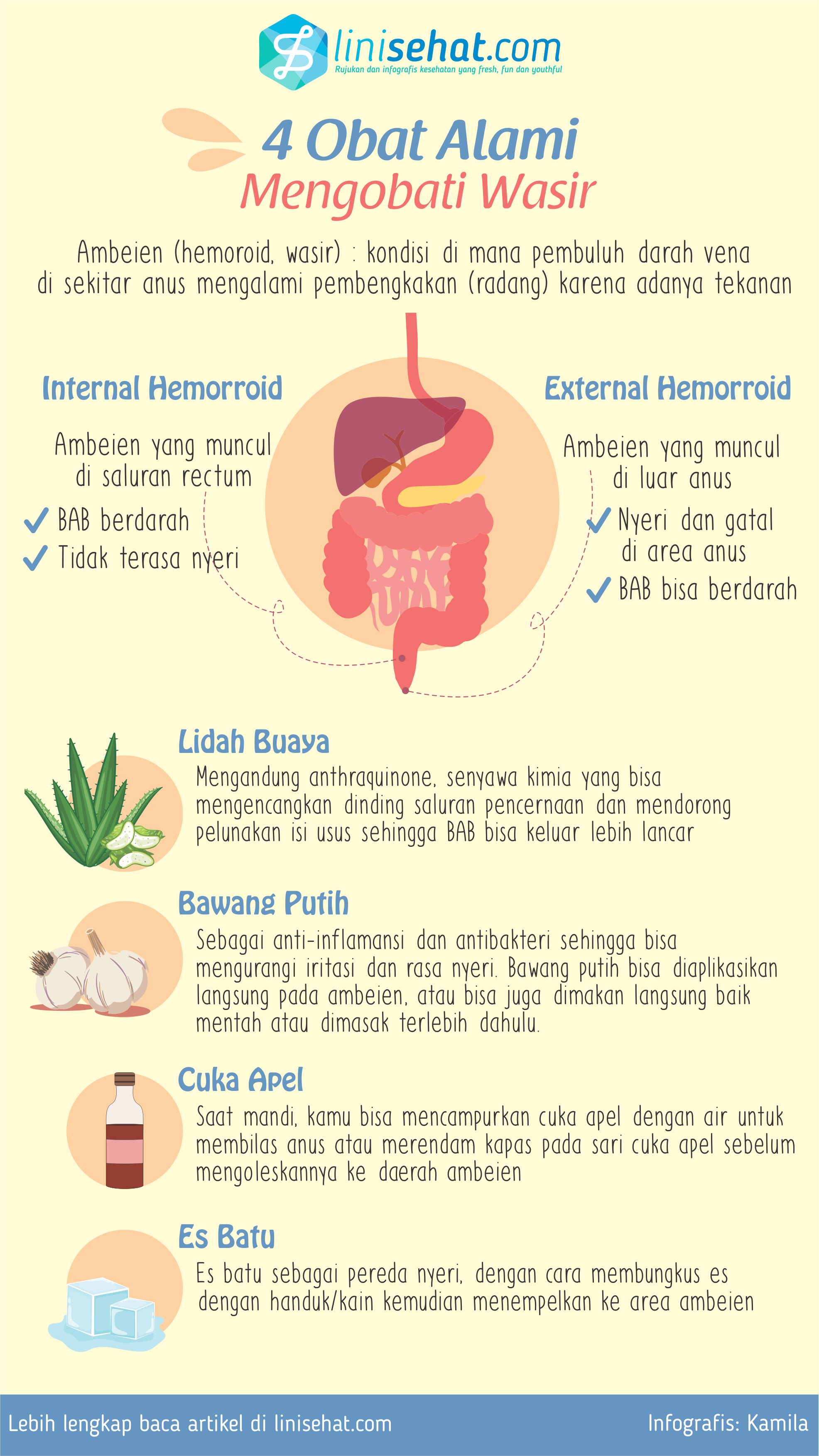 Hemoroid adalah pembengkakan vena di daerah