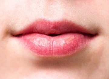 Tips Atasi Bibir Kering saat Beraktivitas di Luar