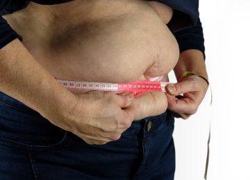 Obesitas Ekstrem Terjadi Lagi, Harus Apa?